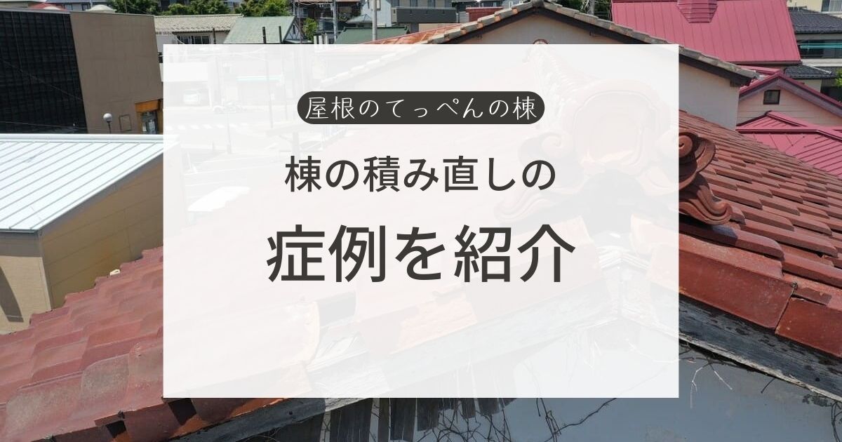 棟の積み直しの症例を紹介